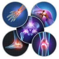 Painful Human Joints